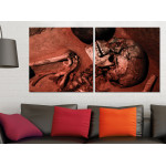 Skelett med Frakturer - Tavla i Tv&aring; delar