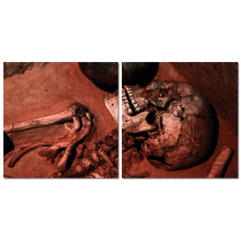 Fractured Skull - Poster in Two Pieces